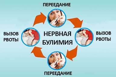 Лечение булимии в Бобруйске